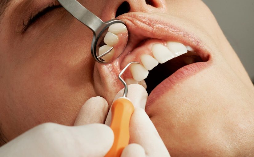 How to Pick the Right Dentist in East Brunswick, NJ (So You Don’t Regret It Later)